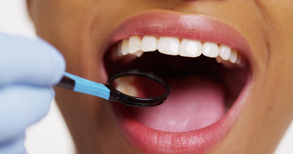 photo of dental exam